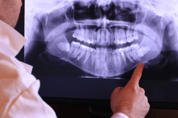 Best Emergency Dental Care for Abscessed Tooth in Hemby Bridge, NC